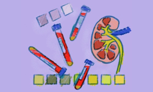 How Are Rare Kidney Diseases Diagnosed? image